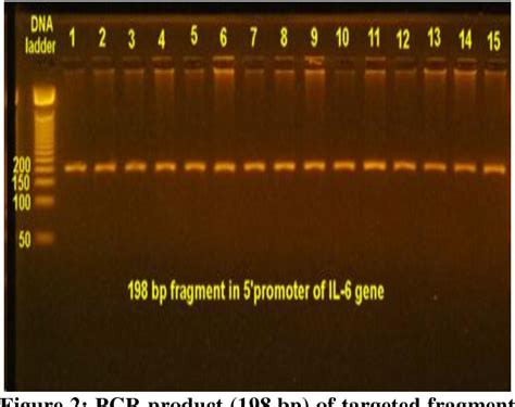 Figure 1 From THE ROLE OF ANTI INFLAMMATORY INTERLEUKINE 4 590C T AND