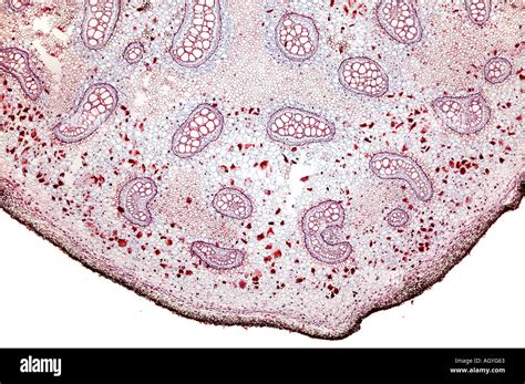 Pteridium Aqulinum Rhizome Transverse Section Fern Photomicrograph