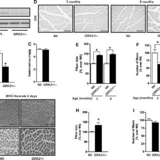 GRK2 hemizygous mice show decreased fiber number and increased skeletal ...