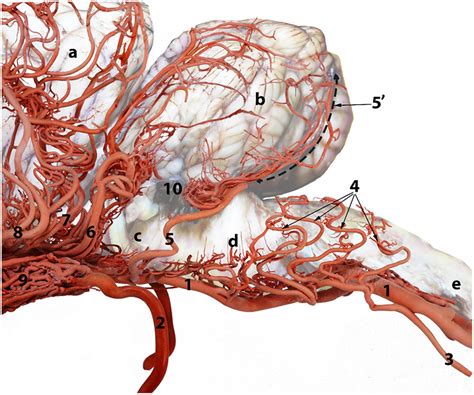 A Composite Photograph Showing The Arterial Supply To The Caudal