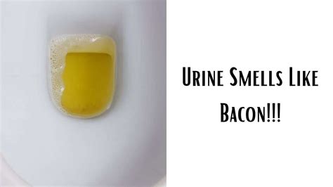 Urine Smells Like Bacon 5 Best Causes And Remedies