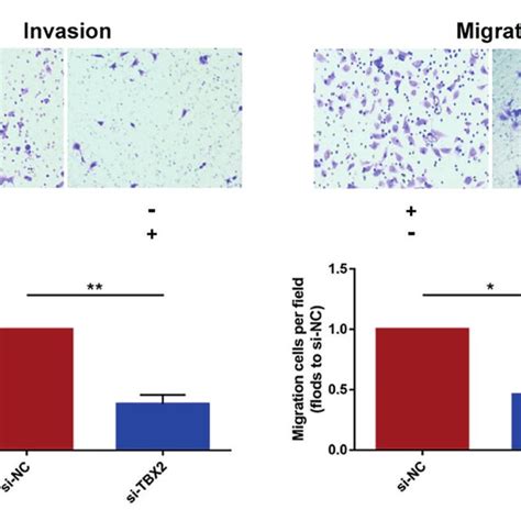 The Invasion And Migration Of Escc Cell Post Transfection Was Analyzed