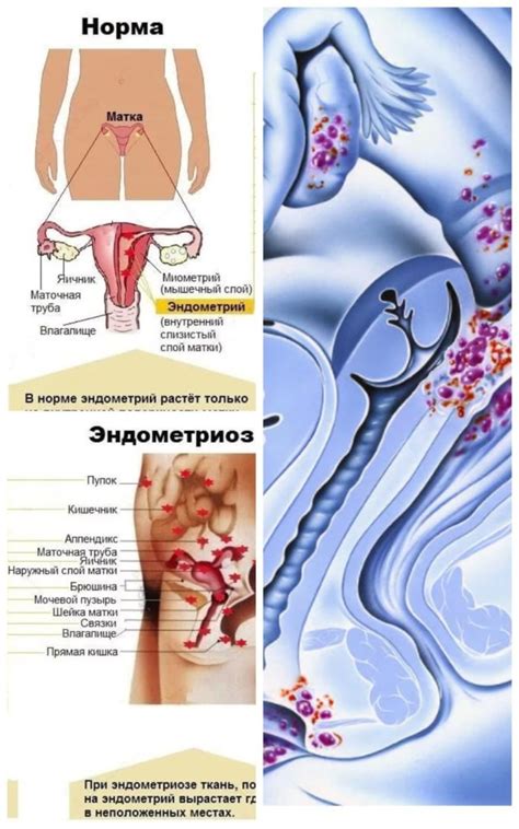 Эндометрин "Вербена" / biospte4ka.ru