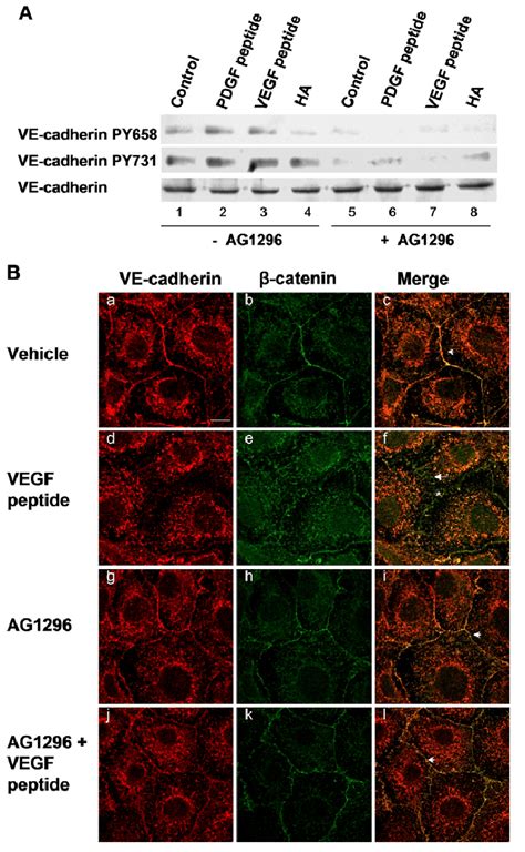 Tyrphostin Inhibits Crsbp Ligand Stimulated Tyrosine Phosphorylation