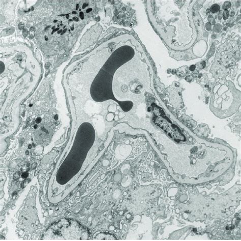 Light Microscopy-Hematoxylin and Eosin stain-40X -High power of the... | Download Scientific Diagram