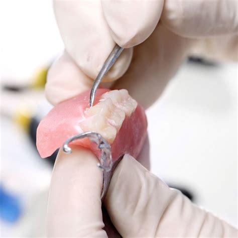 Key Differences Between Acrylic And Porcelain Dentures Dutton