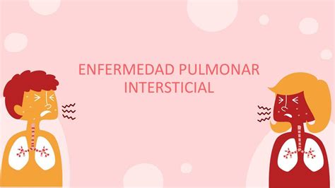 Enfermedad Pulmonar Intersticial Guillermo Adri N Iba Udocz