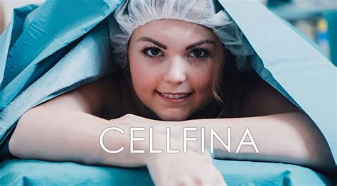 Cellfina Theaesthetics Dr Rolf Bartsch Dr Katrin Bartsch