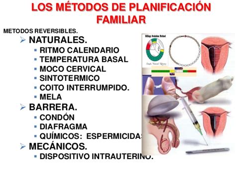 Laparoscopia Metodos De Planificacion Familiar