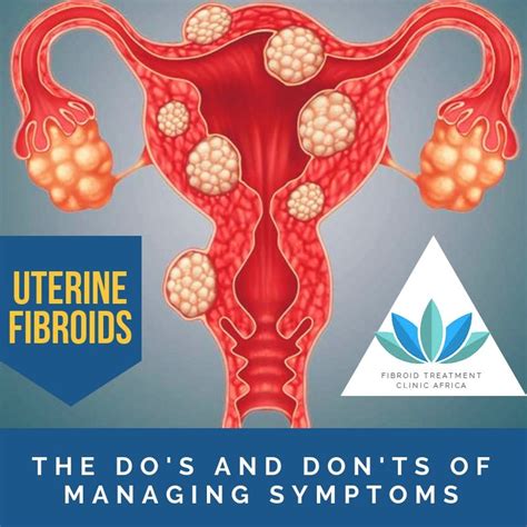 Uterine Fibroids