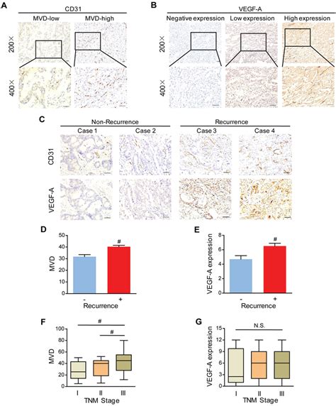 Microvessel Density MVD And Vascular Endothelial Growth Factor A