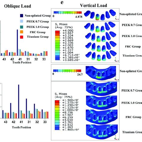 Maximum Von Mises Stresses And Occlusal Views Of Stress Distributions