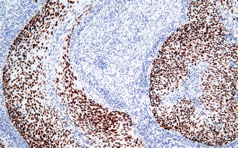 P Antibody Rabbit Monoclonal Antibody Mab Ihc Buy Now