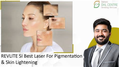 Revlite Si Best Laser For Pigmentation And Skin Lightening Improve Your