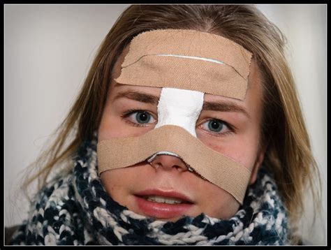 Football Nose Bandage
