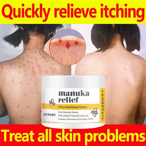 Eczema Ointment Psoriasis Treatment Cream 50g For The Treatment Of Skin Allergies Itchy Skin