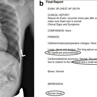 This Portable Anteroposterior Chest Radiograph A In A 9 Year Old Boy