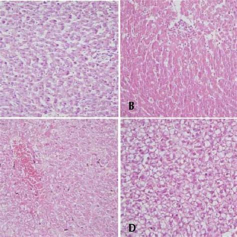 Histopathological Effects Of High Dose Methotrexate On The Liver