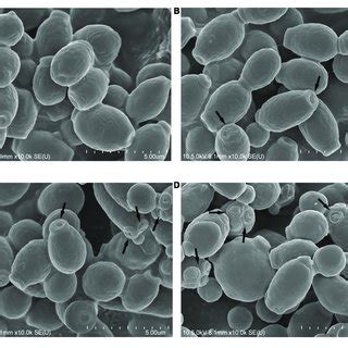 | Scanning electron microscopy. (A) Negative control, 0.9% saline; (B ... 