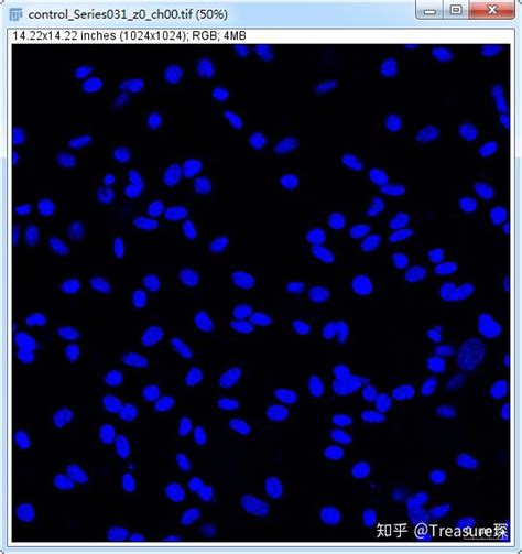 Imagej实用技巧——单个细胞平均荧光强度自动检测定量分析篇 知乎