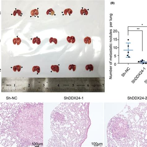 Ddx Knockdown Suppresses The Metastasis In Vivo A Representative