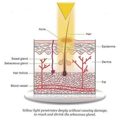 Pimple Treatment And Acne Treatment Dr Harold Ma