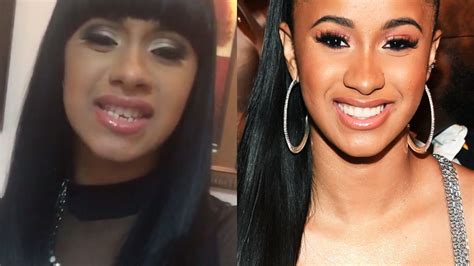 5 Celebrities with Veneers Who are Open About Their Experience