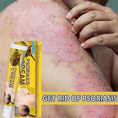 Psoriasis Cream Eczema Herbal Cream Herba Psoriasis Cream Antifungal Cream Bacteriostasis Eczema