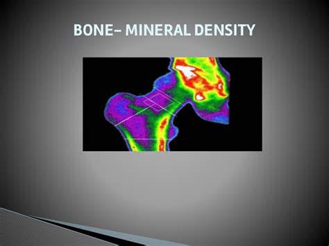 Bone Marrow Density Bmd