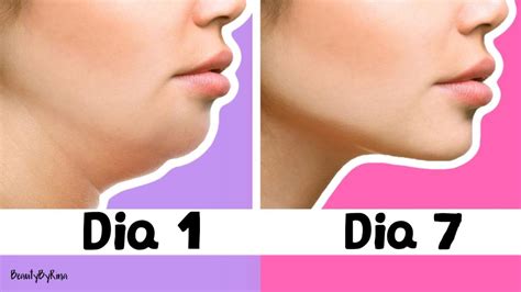 ֍ Ejercicios Para Disminuir La Papada Tonifica Los Músculos De Tu Cuello ⚕️ Clínica Estemedic