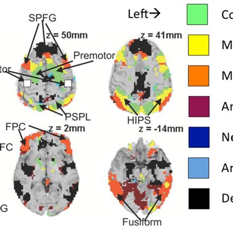 Classification Of Different Brain Regions In Terms Of Their Activation Download Scientific