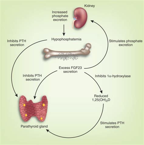 FGF23parathyroid Interaction Implications In Chronic Kidney Disease