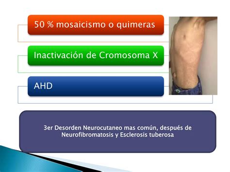 Hipomelanosis De Ito PPT Descarga Gratuita