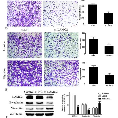 Knockdown Of LAMA3 Inhibits PDAC Cell Proliferation Migration