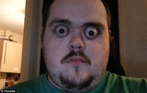 Is It Possible To Open Your Eyes Too Wide Making Them Pop Out