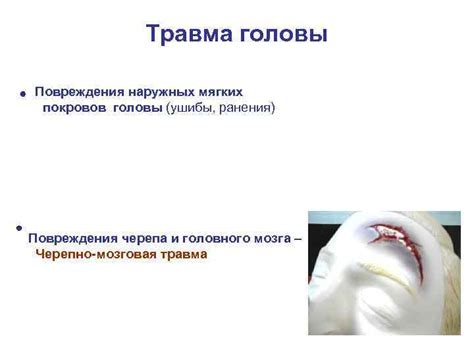 Травма головы Анатомия головы