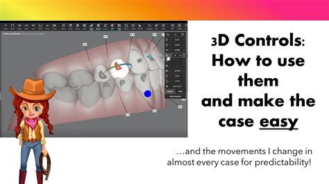 Invisalign ClinCheck Modifications With 3D Controls YouTube