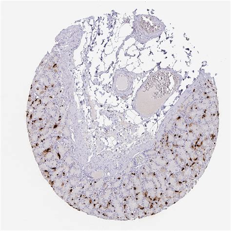 Tissue Expression Of Chga Staining In Stomach The Human Protein Atlas