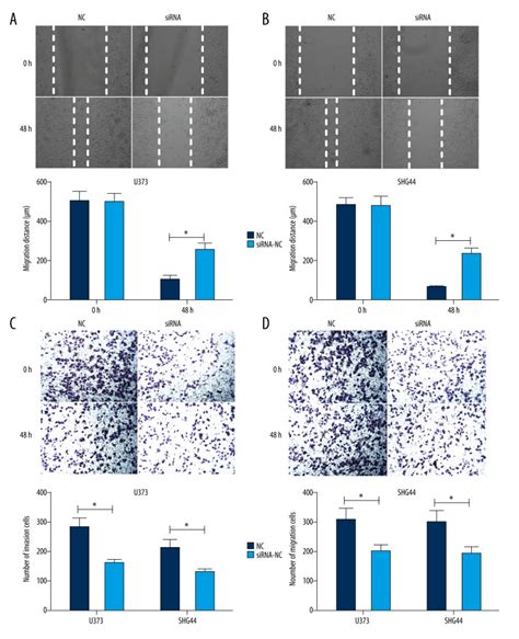 Circular Rna Hsa Circ 0012129 Promotes Cell Proliferation And Invasion