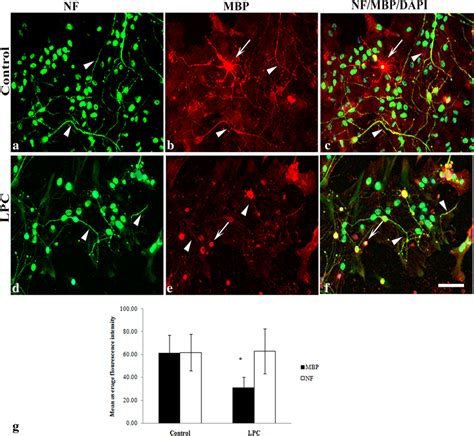 LPC Induced Model Of Demyelination Af LPC Induced A Loss Of MBP