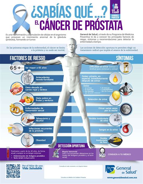 Infografiacancerprostata Infonogales