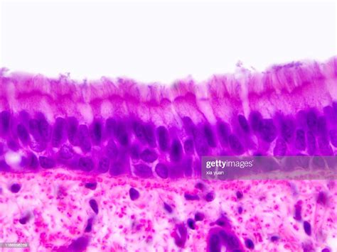 Simple Ciliated Columnar Epithelium