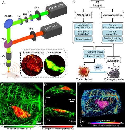 Photoacoustic Guided Photothermal Therapy By Mapping Of Tumor