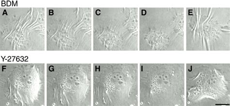 Reversible Suppression Of Cell Contractility By Bdm And Y Sv