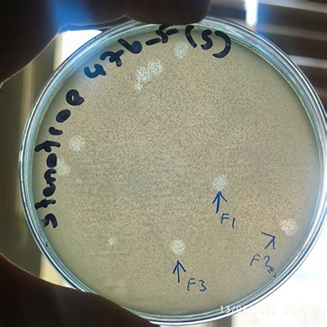 Stenotrophomonas Maltophilia Bacteriophage 200476f Mikroliz