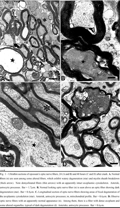 Scielo Brasil Erratum To Watery And Dark Axons In Wallerian