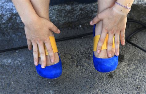 ‘Cinderella Surgery’ On The Rise In US; Women Reshape Feet To Better