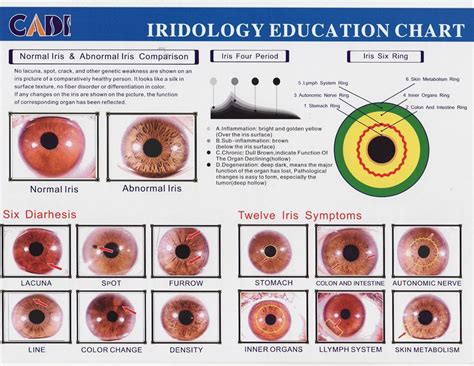 Bernard Jensen Iridology Chart Here S A Quick Way To Get It Iriscope