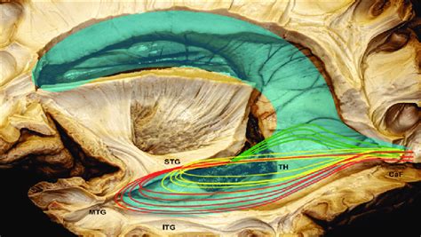 Illustration Of Optical Radiation Superimposed On The Dissected Download Scientific Diagram