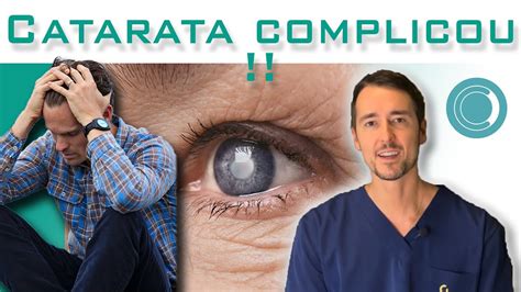 Catarata Complicou E N O Deu Para Implantar A Lente Intraocular